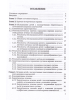 Ортопедические последствия гематогенного остеомиелита верхних конечностей у детей