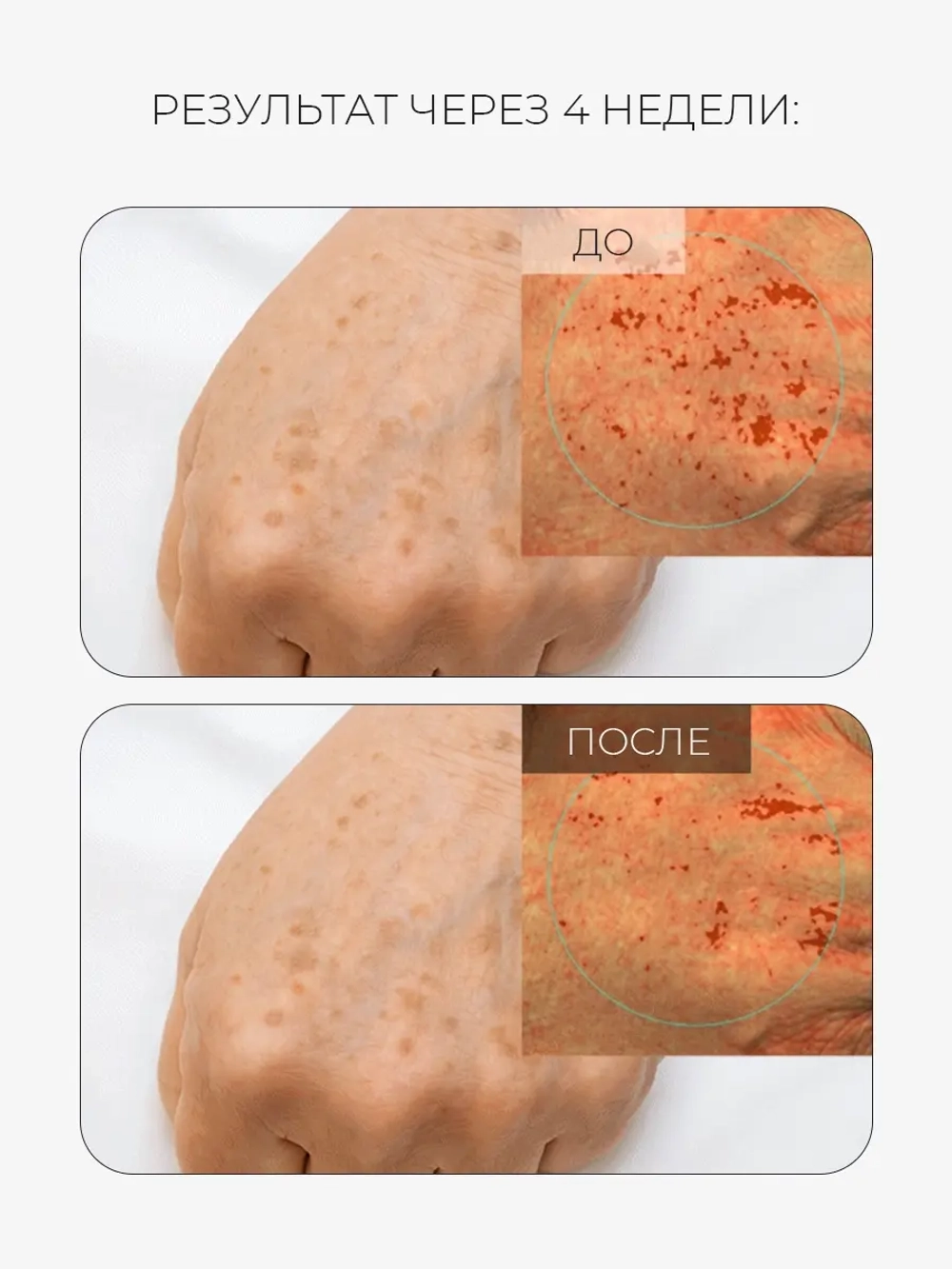 Arocell Солнцезащитная сыворотка с транексамовой кислотой, мелатонином и глутатионом SPF50 Mela TXA Sun Serum 40 мл