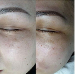 PDRN Rejuvenating Ampoule Eldermafill | Мощная регенерация