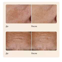 Artistry LongXevity™ Насыщенный восстанавливающий крем для лица (сменный блок)