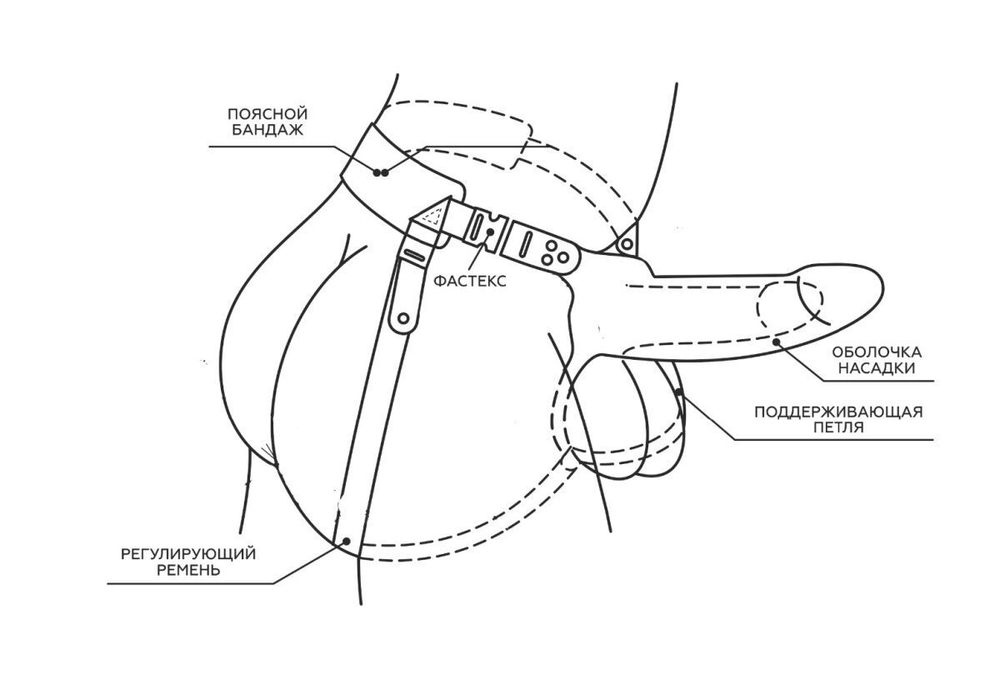 Телесный поясной парапротез - 17 см. (Цвет: телесный)