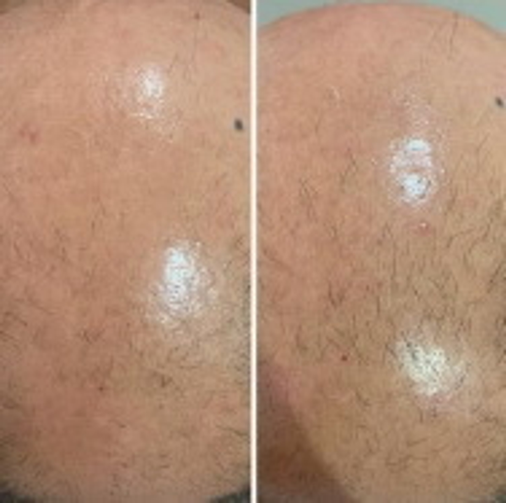 Hair Forest Ampoule Eldermafill | Восстановление волос