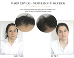 VALDORE INTENSIVE HAIR LOSS PREVENTION PROGRAM