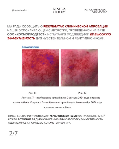 Сыворотка успокаивающая для чувствительной кожи