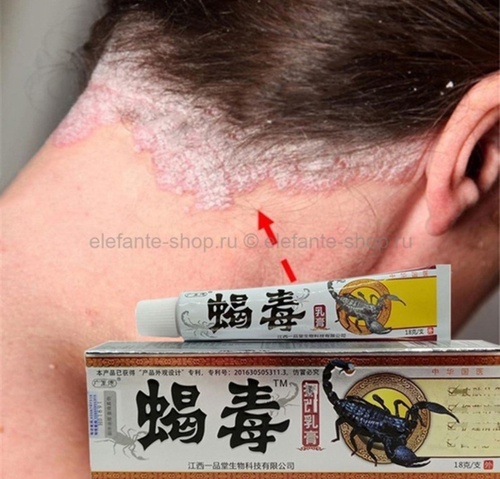 Мазь от псориаза