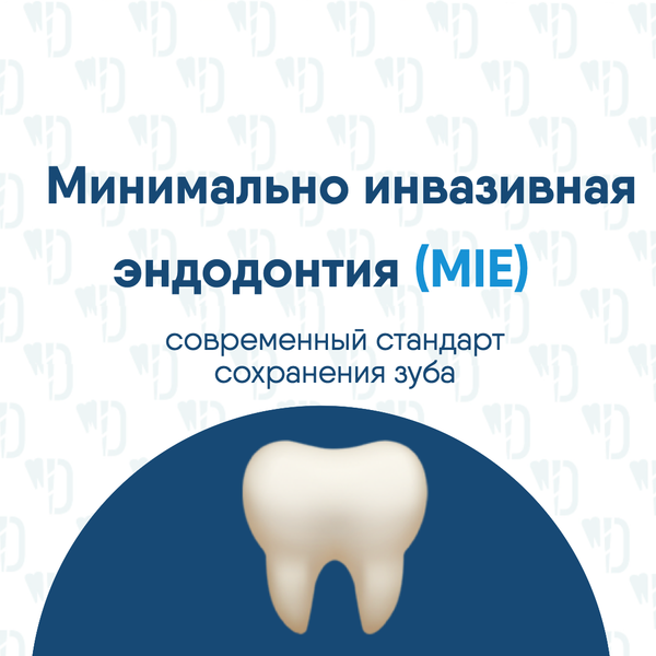 Минимально инвазивная эндодонтия (MIE)