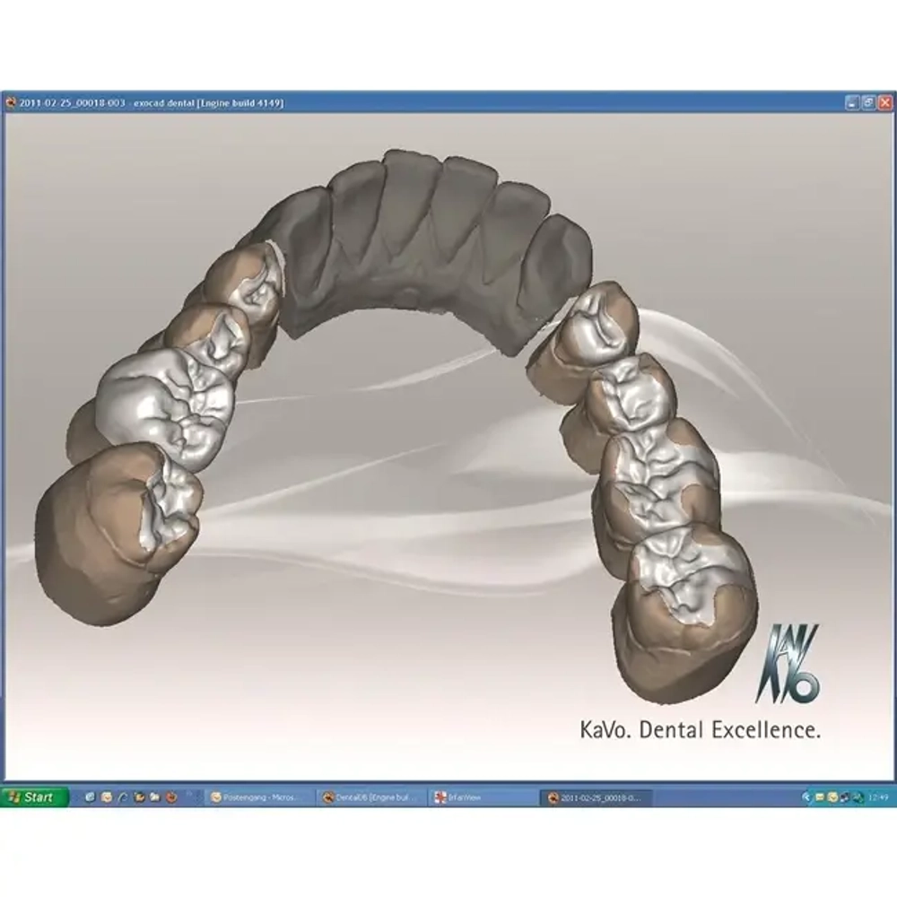 KaVo ARCTICA advanced - CAD/CAM система | KaVo (Германия)