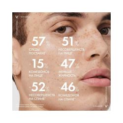 Vichy Normaderm Гель-сыворотка очищающая с эффектом пилинга, 125 мл