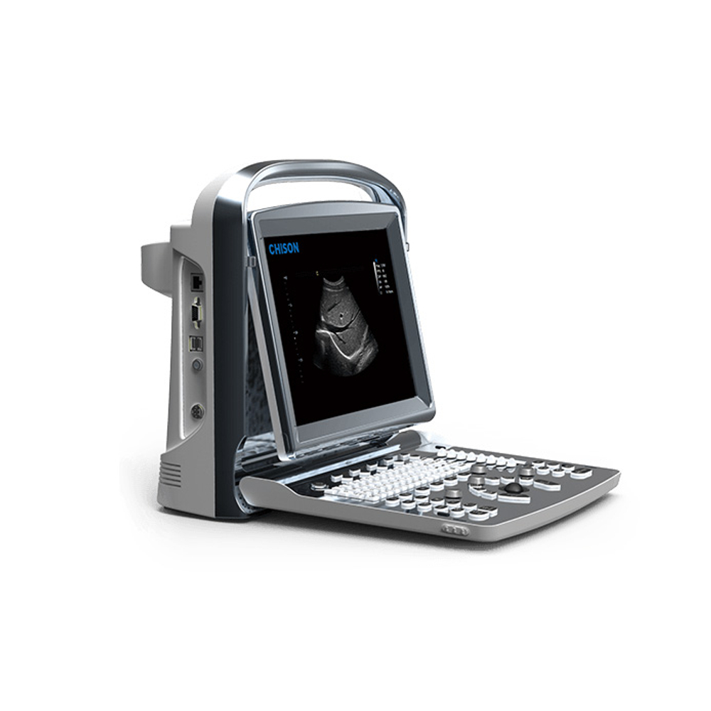 Ультразвуковой аппарат Chison SonoTouch 10
