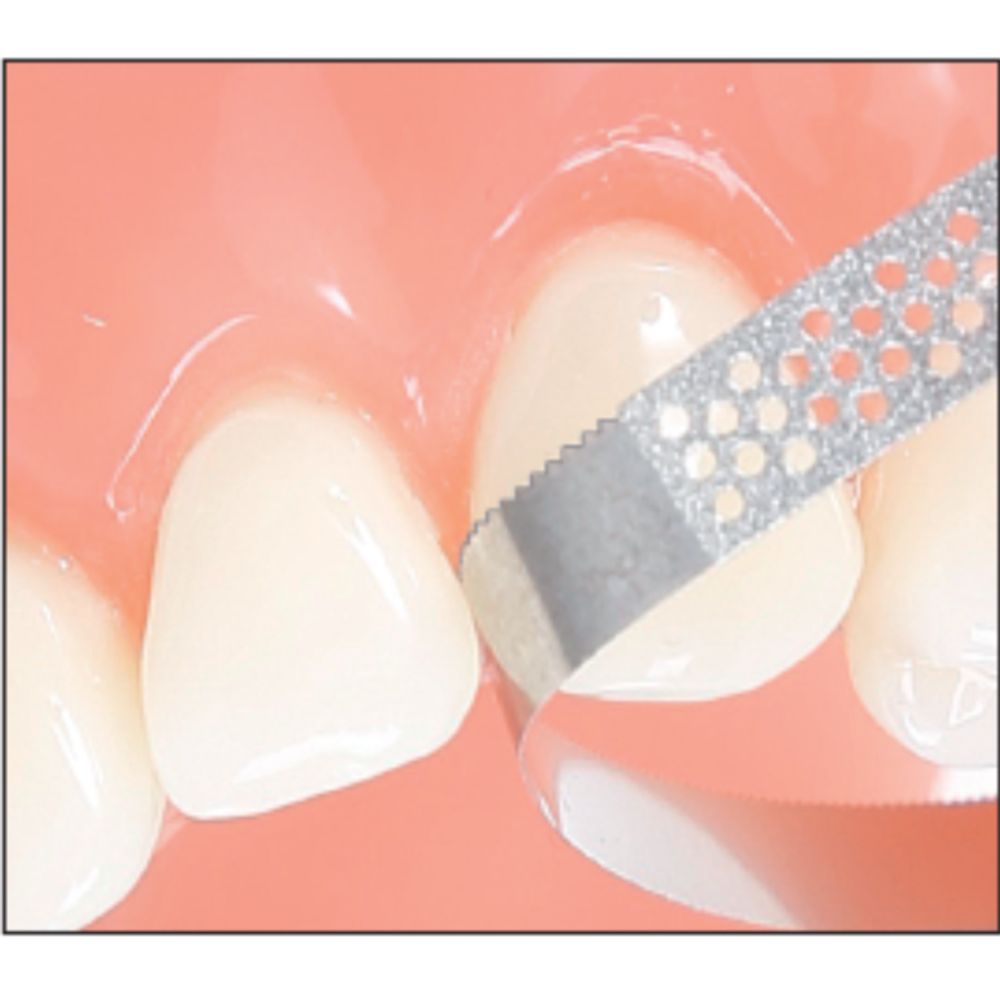 EDENTA PXDS2 Алмазные перфорированные финишные полоски штрипсы XDS2 с пилкой, зернистость стандартная