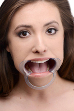 Расширитель рта Cheek Retractor Dental Mouth Gag (Цвет: голубой)
