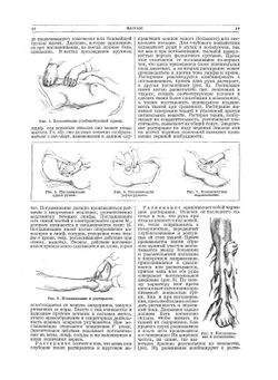 Большая медицинская энциклопедия. том 17 Массаж - Метрит | Н.А. Семашко