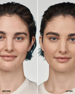 Clinique Even Better Clinica Serum Foundation - Тональная основа с защитой SPF 20 оттенок CN 62 Porcelain Beige, 30 ml