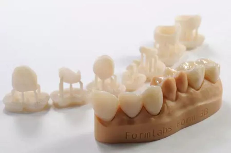 3D-печать постоянных коронок с помощью SLA 3D-принтера Form 3B и Permanent Crown Resin