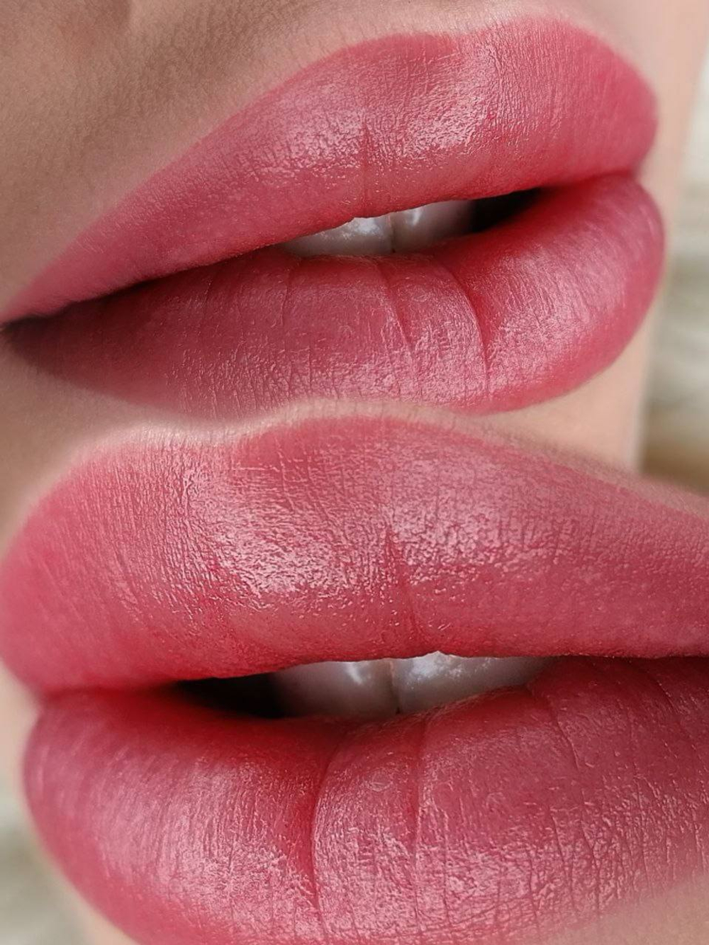 RASPBERRY