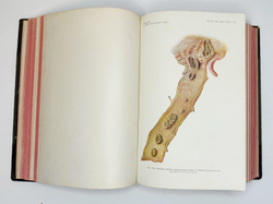 Eulenburg A., проф. Эйленбург А  Реальная энциклопедия практической медицины в XVII томах. 1909-1915