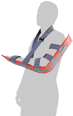 Комплект шин транспортных лестничных (с фиксирующими ремнями)