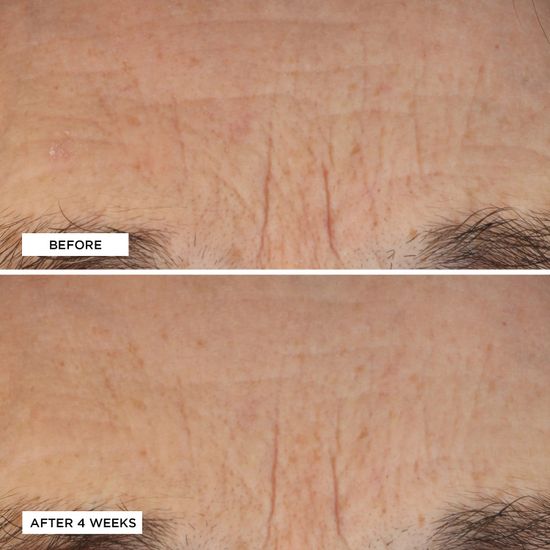 Сыворотка Perricone MD Neuropeptide Deep Crease Serum 