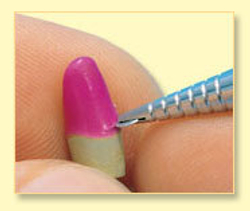 Колесовидный шпатель