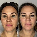 Rejusome | Сыворотка для омоложения кожи лица с экзосомами