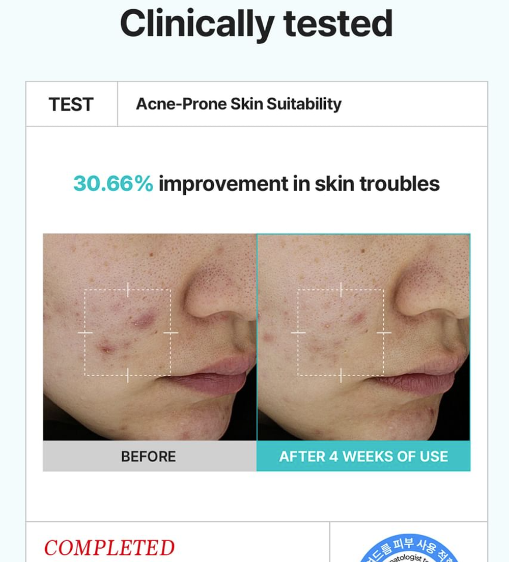 Крем с 5% азелаиновой икслотой SKIN&LAB Azelaic acid balancung moisturizer, 100мл