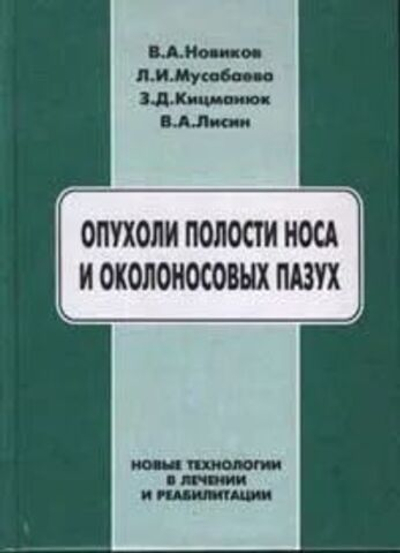 Опухоли полости носа и околоносовых пазух