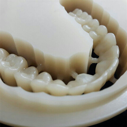 Временные коронки