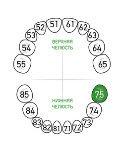 Зона применения клампа для коффердама/раббердама №75 для молочных зубов KSK Dentech (Япония)