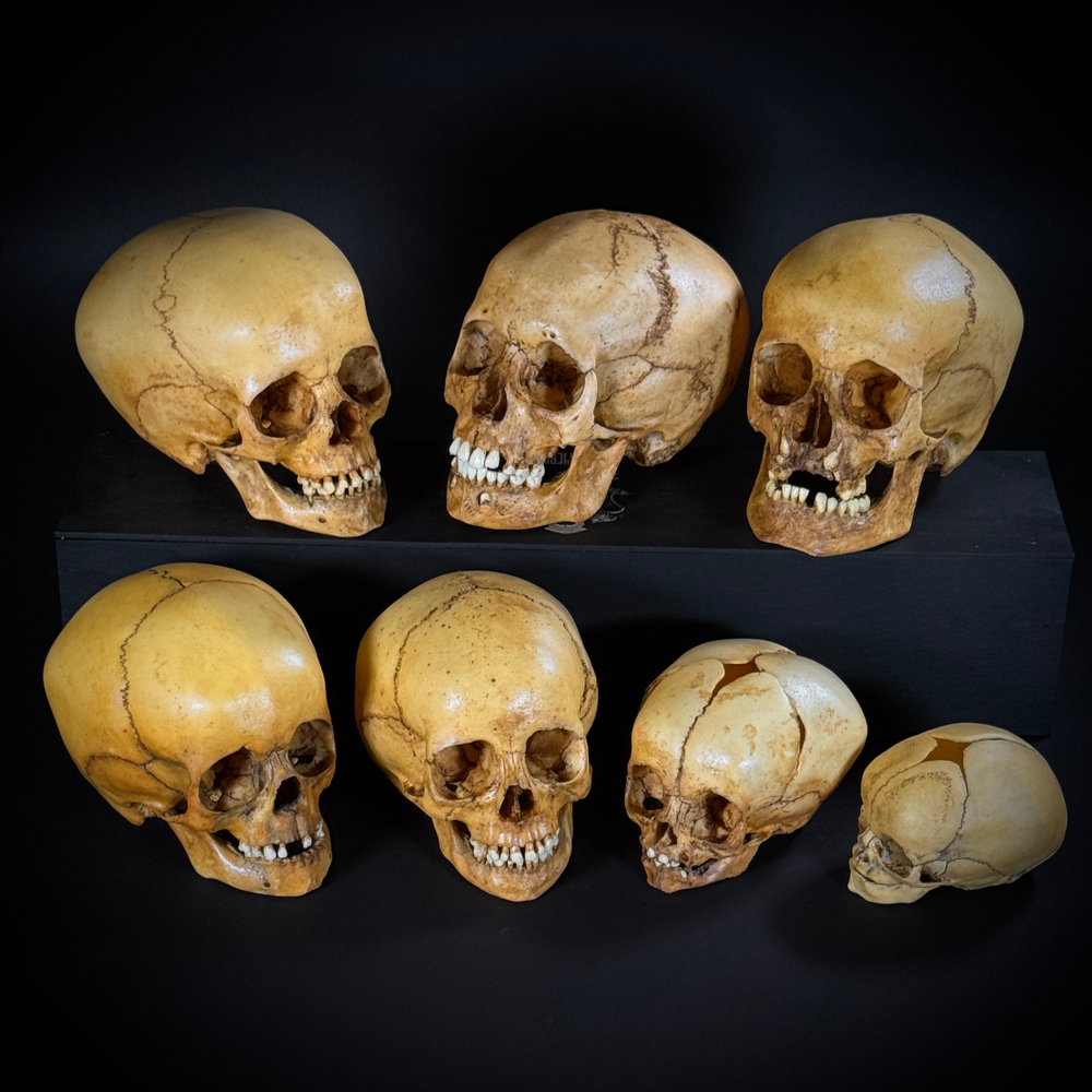 Набор «Череп человека» (анатомические модели)