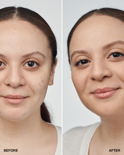 Clinique Even Better Clinical Serum Foundation SPF 20 - Тональная основа SPF 20, 30 ml