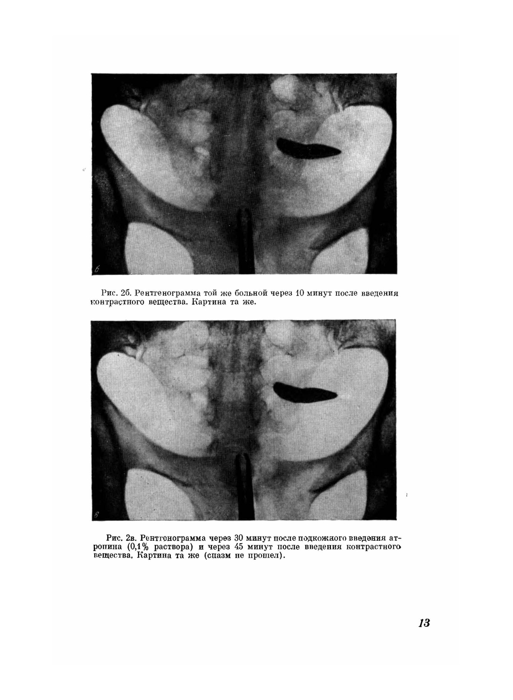 Атлас гистеросальпингографии | М.М. Абрамова