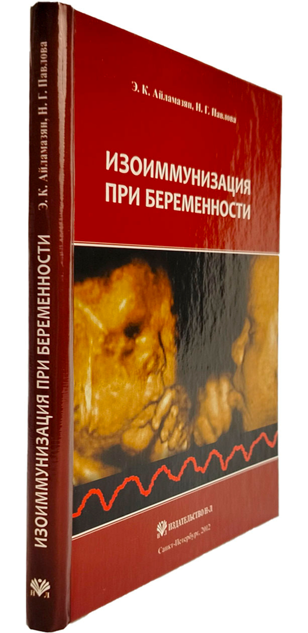 Изоиммунизация при беременности