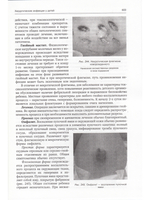 Госпитальная хирургия т.2 2-е издание