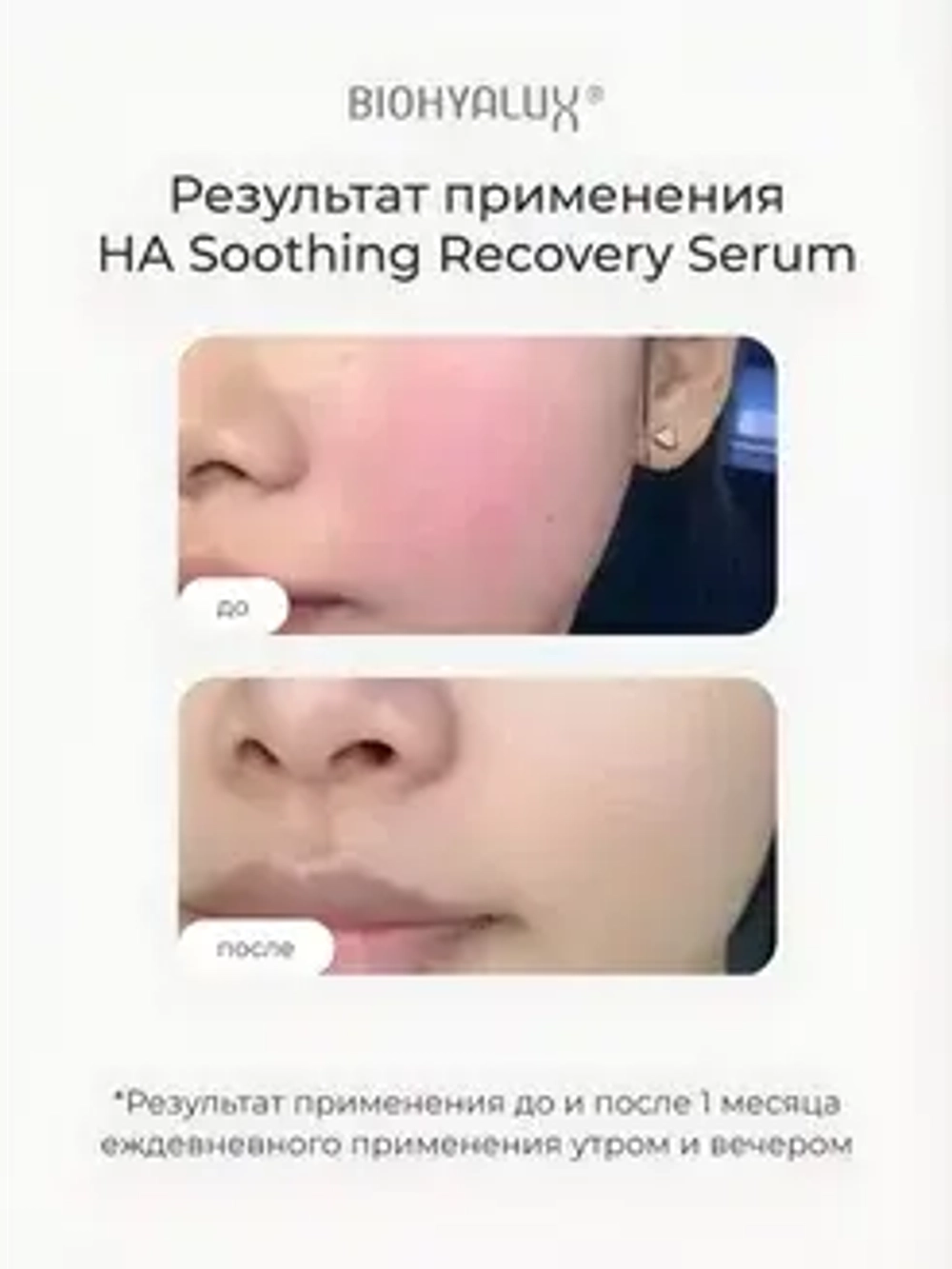 Сыворотка успокаивающая восстанавливающая с гиалуроновой кислотой | BIOHYALUX НА SOOTHING RECOVERY SERUM 30х1,5 мл