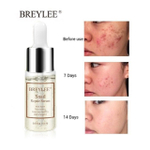 Сыворотка Breylee восстанавливающая Snail Repairing Serum Anti-Acne с муцином улитки 15 мл