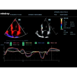 Аппарат УЗИ (сканер) Mindray DC-60