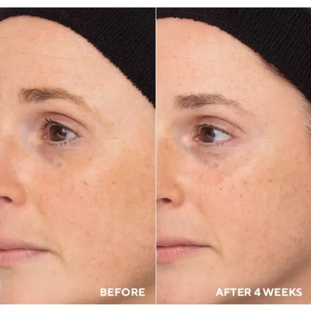 Ретиноловый бустер 1% с обновляющим и уплотняющим действием