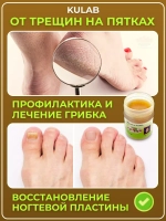 Тайская мазь от грибка ногтей, микоза и трещин на пятках