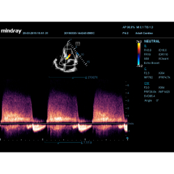 Аппарат УЗИ (сканер) Mindray DC-55