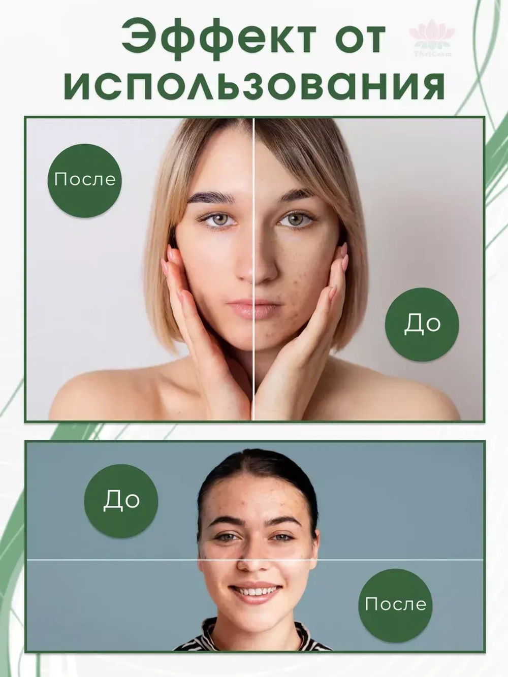 Отбеливающий крем для лица от пигментаци