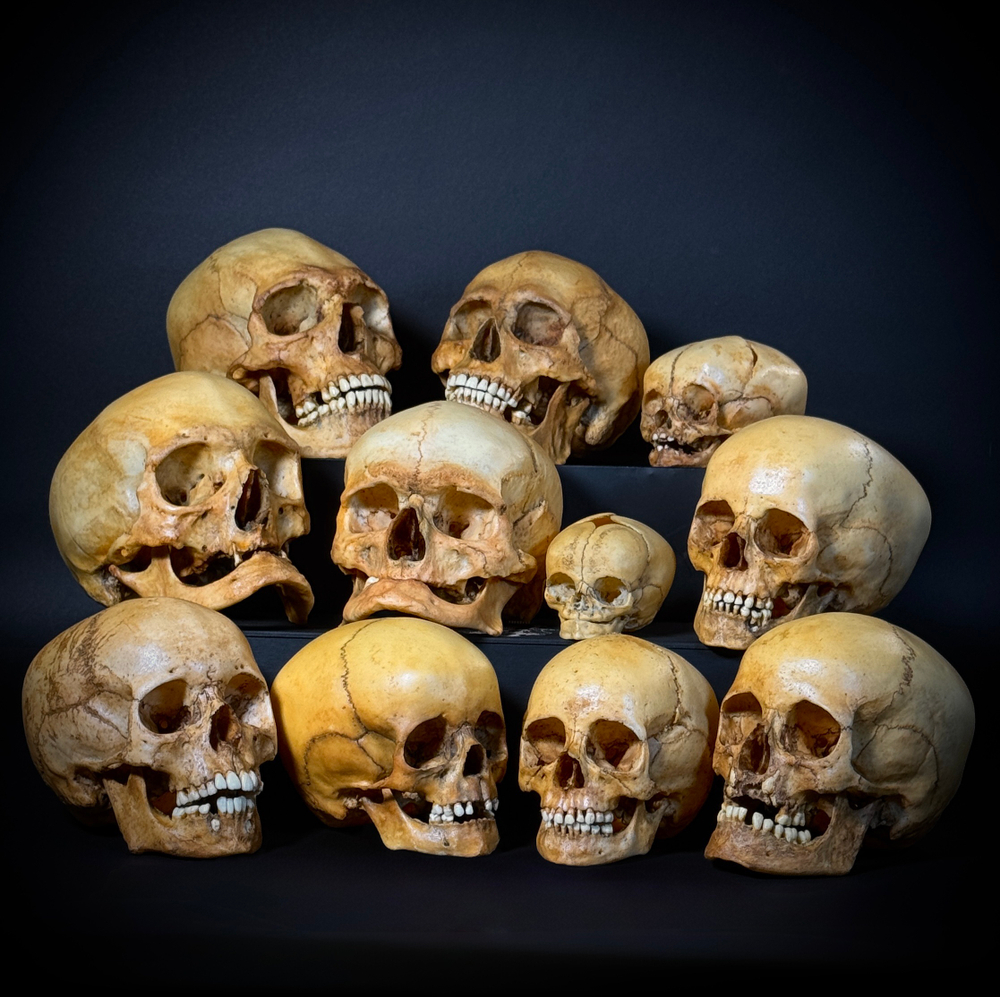 Набор «Череп человека» (анатомические модели)