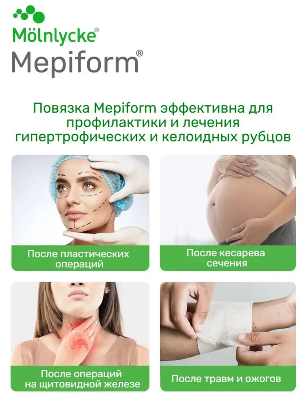 Мепиформ/ Мепиформ 5х7.5см, 1шт для лечения рубцов