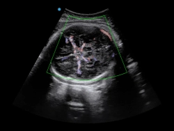 Аппарат УЗИ SIUI Apogee 5500