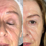 Rejusome | Сыворотка для омоложения кожи лица с экзосомами