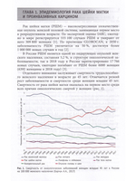 Первичная и вторичная профилактика рака шейки матки