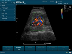 Аппарат УЗИ Edan U2 (без УЗИ датчиков)