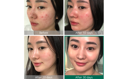 Some By Mi AHA/BHA/PHA 30 Days Miracle Travel KIT 3 набор для проблемной кожи из 3 средств
