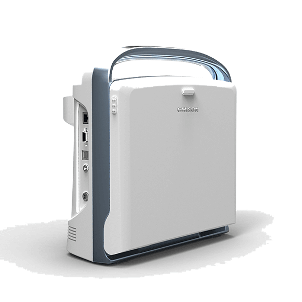 УЗИ аппарат CHISON ECO 1