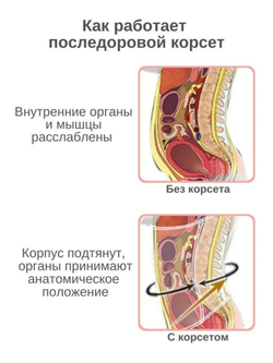 Бандаж после родов и кесарева сечения, послеоперационный абдоминальный пояс