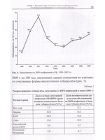 Туберкулез глаз и сходные с ним заболевания. Руководство для врачей. 2е изд.